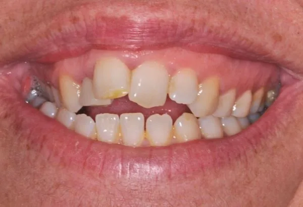 Before - Peacock Dental Spa