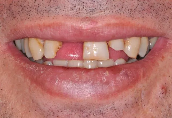 Before - Peacock Dental Spa