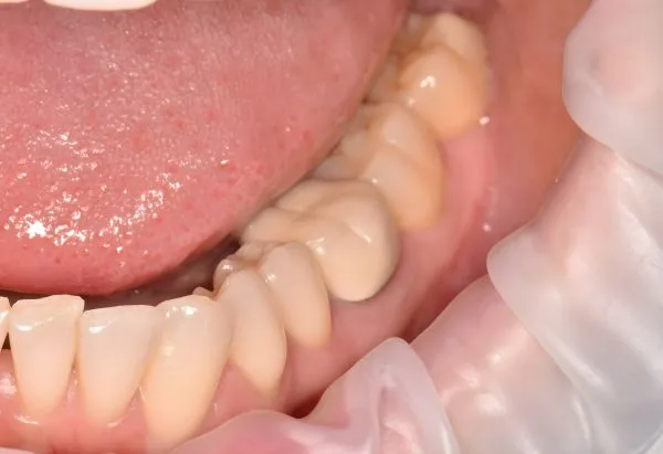 Before - Peacock Dental Spa
