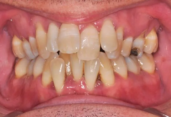 Before - Peacock Dental Spa