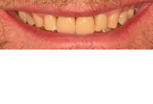 After -Peacock Dental Spa