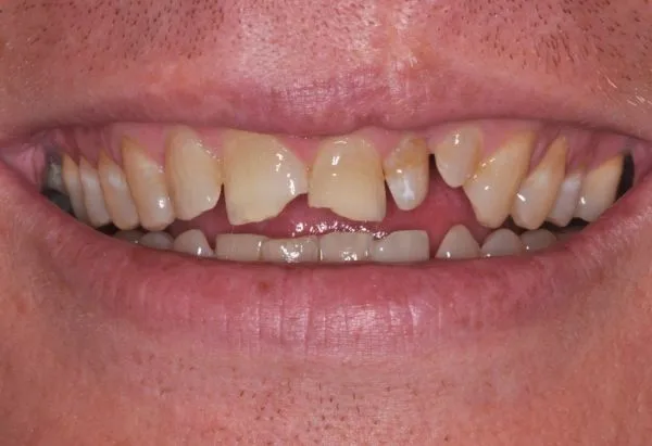 Before - Peacock Dental Spa