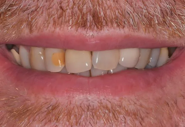 Before - Peacock Dental Spa
