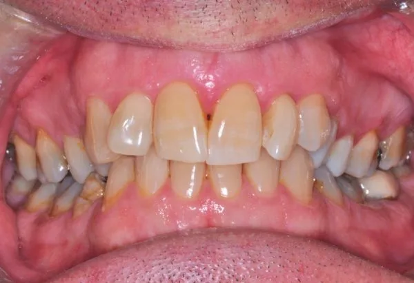 Before - Peacock Dental Spa