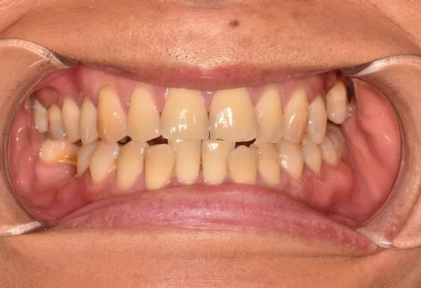 Before - Peacock Dental Spa