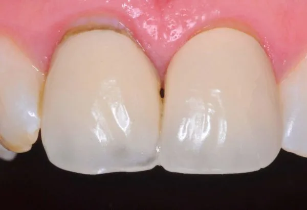 Before - Peacock Dental Spa