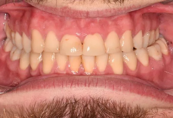 Before - Peacock Dental Spa