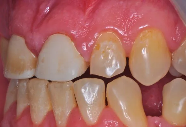 Before - Peacock Dental Spa