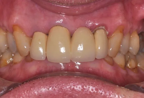 Before - Peacock Dental Spa