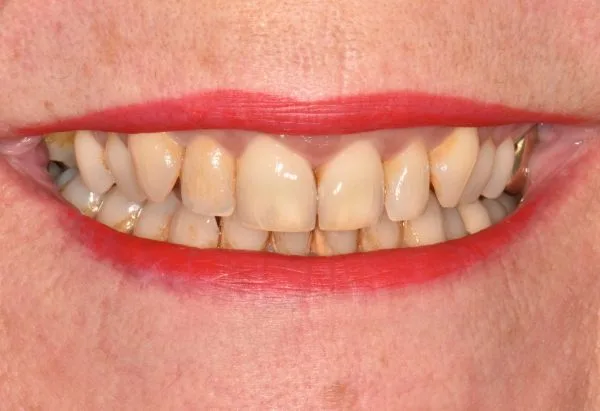 Before - Peacock Dental Spa