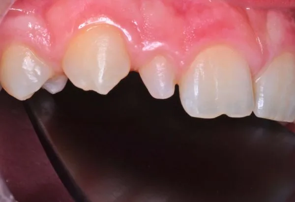 Before - Peacock Dental Spa