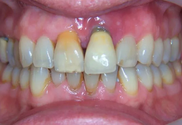 Before - Peacock Dental Spa