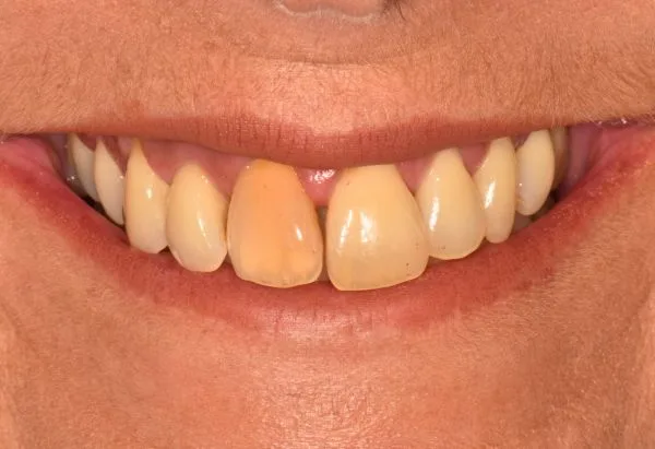 Before - Peacock Dental Spa