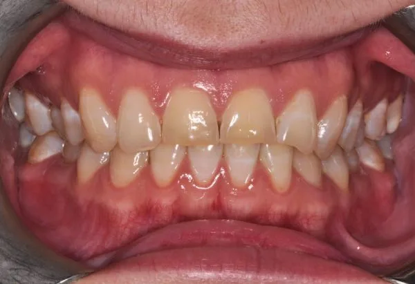 Before - Peacock Dental Spa