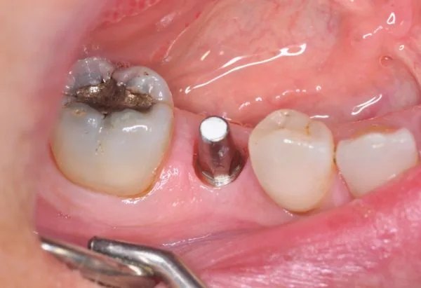 Before - Peacock Dental Spa