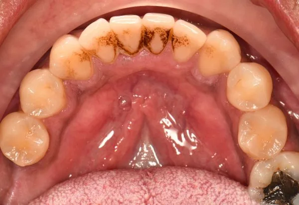 Before - Peacock Dental Spa