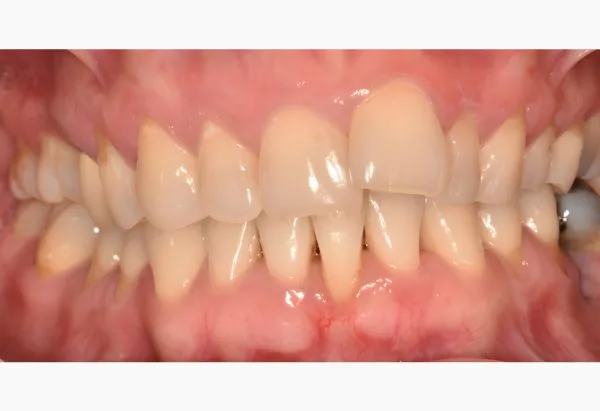 Before - Peacock Dental Spa