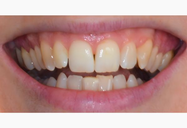 Before - Peacock Dental Spa