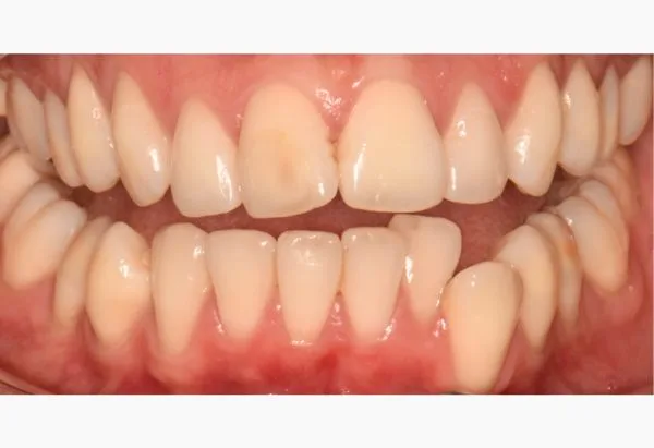 Before - Peacock Dental Spa