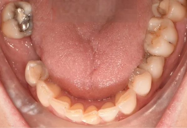Before - Peacock Dental Spa